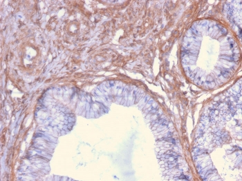 Drebrin 1 Antibody