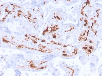 Factor XIIIa Antibody / F13A1