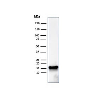 FABP5 Antibody (epidermal)