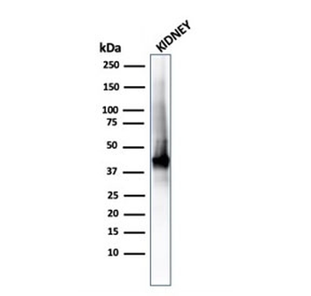AMACR / p504S Antibody (Prostate Cancer Marker)