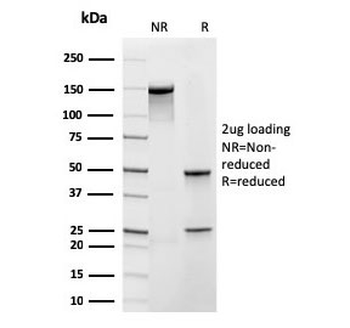 Frataxin Antibody / FXN