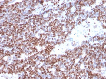 Estrogen Receptor alpha Antibody