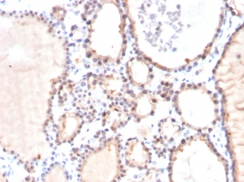 GLO1 Antibody / Glyoxalase I