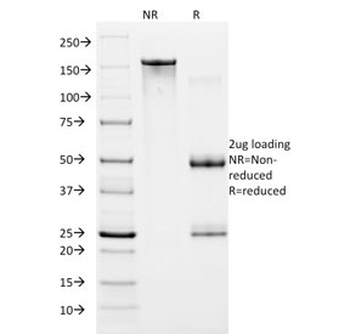 HIF1A Antibody / HIF-1 alpha