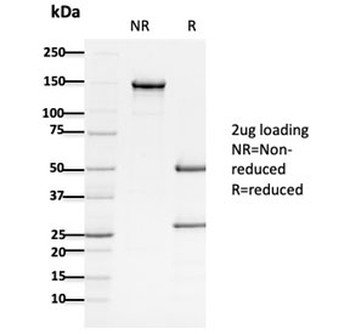 APC Antibody / Adenomatous polyposis coli
