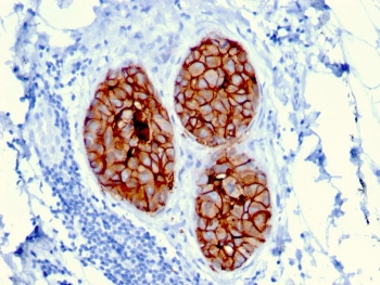 HER2 Antibody / ErbB2