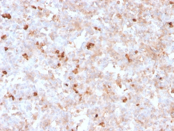 Lambda Light Chain Antibody / Lambda Antibody