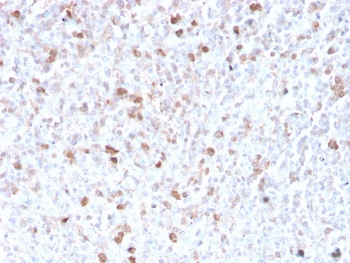 Lambda Light Chain Antibody / Lambda Antibody