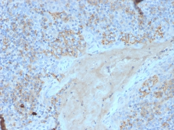 Fas Antibody / CD95