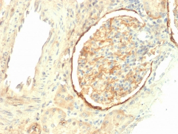 Integrin beta 3 Antibody / ITGB3 / CD61