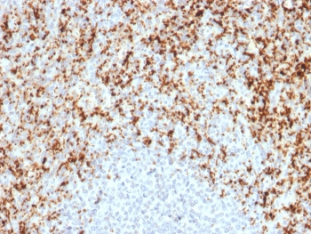 Integrin beta 3 Antibody / ITGB3 / CD61