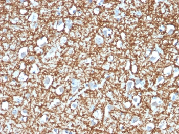 ARF1 Antibody
