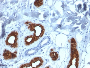 Cytokeratin 3 Antibody / KRT3