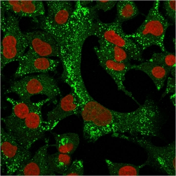 Cytokeratin 4 Antibody / KRT4