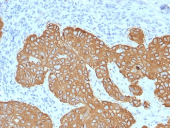 Cytokeratin 5 Antibody / KRT5