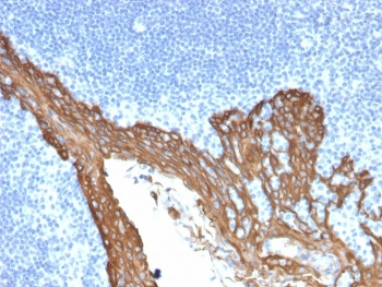 KRT8 Antibody / Cytokeratin 8