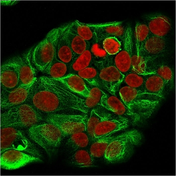 KRT15 Antibody / Cytokeratin 15