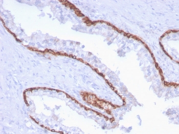 KRT15 Antibody / Cytokeratin 15