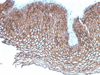 Desmoglein 3 Antibody / DSG3