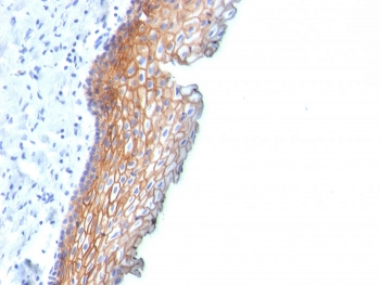 Desmoglein 3 Antibody / DSG3