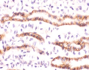 Erythropoietin Antibody / EPO