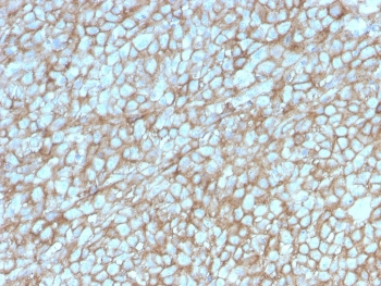 CD146 Antibody / MCAM / MUC18