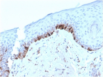 TRP1 / Tyrosinase-Related Protein-1 Antibody