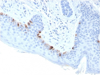 TRP1 / Tyrosinase-Related Protein-1 Antibody