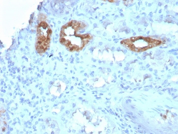Calbindin Antibody / CALB1