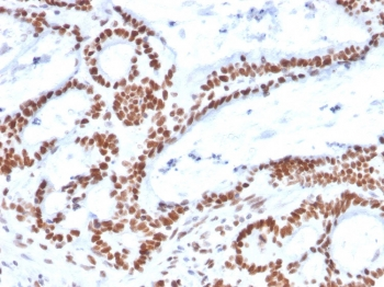MSH2 Antibody