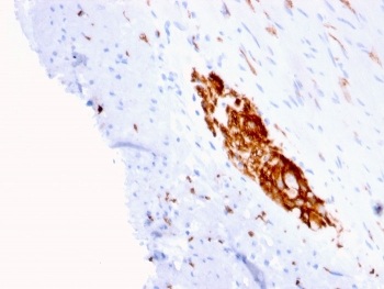 NCAM / CD56 Antibody