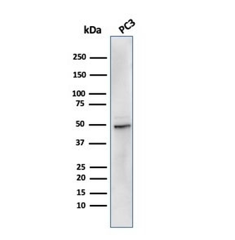 Ornithine Decarboxylase Antibody / ODC1