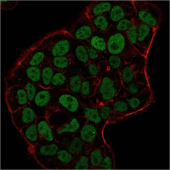 MSH6 Antibody