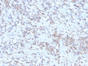 RBP Antibody / Retinol Binding Protein 1