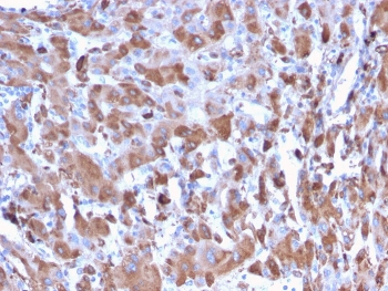 C1QA Antibody / Complement C1q A-Chain