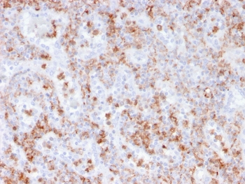 S100A9 Antibody / MRP14 / Calgranulin B / Calprotectin L1H