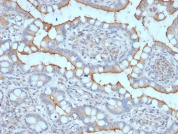StAR Antibody / Steroidogenic acute regulatory protein