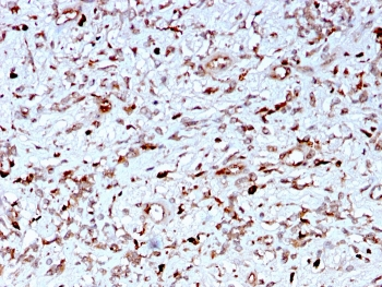 C1QA Antibody / Complement C1q A-Chain