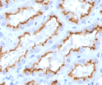 Interferon gamma Antibody / IFNG