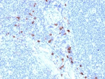 TPSAB1 Antibody / Mast Cell Tryptase