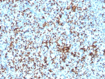 Integrin beta 3 Antibody / ITGB3 / CD61