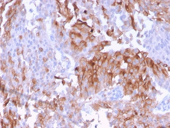 Uroplakin 1B Antibody / UPK1B