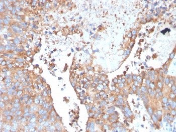 Uroplakin 1B Antibody / UPK1B