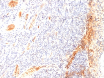 VEGF Antibody