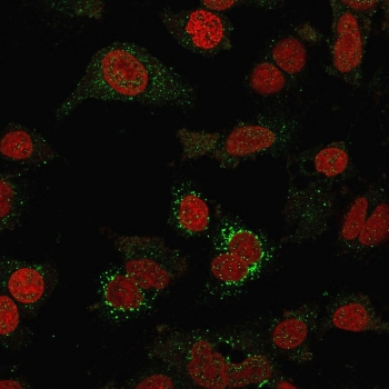 VTCN1 Antibody / B7H4