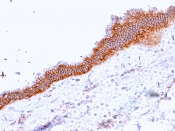 ABCC3 Antibody / MRP3