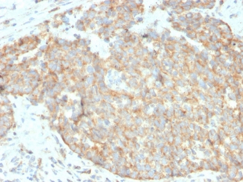 TRAIL R2 Antibody / DR5