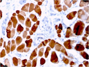 ACTN2 Antibody / Alpha Actinin 2 / Sarcomeric Alpha Actinin
