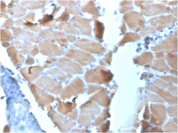 ACTN2 Antibody / Alpha Actinin 2 / Sarcomeric Alpha Actinin
