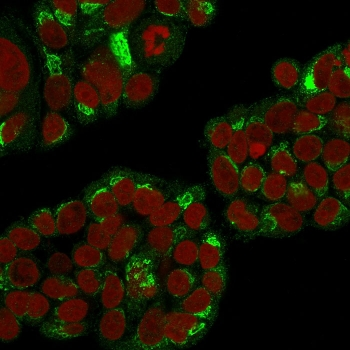 EBAG9 Antibody / Estrogen Receptor Binding Site Associated Antigen 9